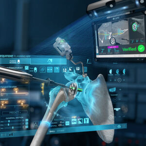 GPS Shoulder Exactech Active Intelligence